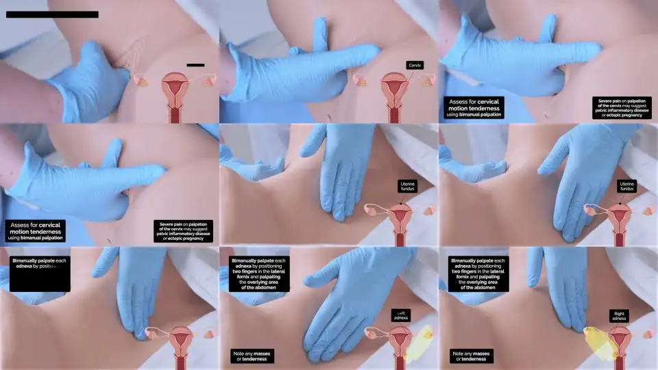 Vaginal Examination (PV) | Bimanual | OSCE Guide | UKMLA | CPSA