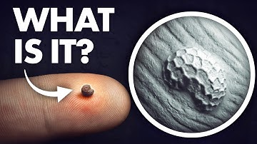 The Weirdest Microscope