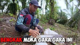 Download lagu Swollen Face Due to Playing Sinso Stihl