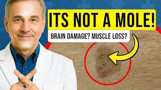 That’s NOT a Mole! UNCOVERING the MYSTERY of Sjögren’s and Fibromyalgia (This Can SAVE Your LIFE)