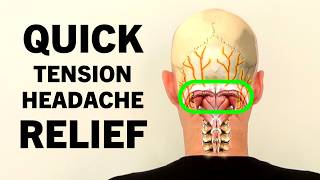 Tension Headache Exercises. Stress Headache Relief in 4 Minutes.