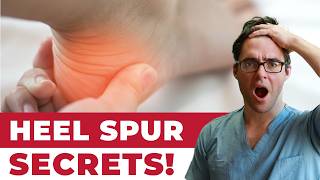 BEST Heel Spur Pain Treatments [Causes, Exercises &  Remedies]