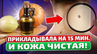 Папилломы и бородавки отпадают сами! Лучшие рецепты!