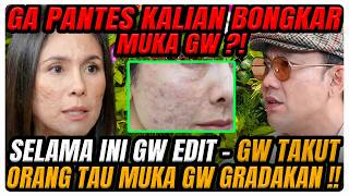 NETIZEN BONGKAR MUKA WULAN ASLINYA GRADAKAN‼️ SAMPAI KE PSIKOLOG-NANGIS-HINGGA LUKA BR*K3N HOME ⁉️