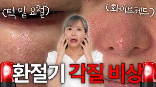 피지 줄고 수분은 늘까? 건성 전용 각질·피지케어 4종 비교🫢 (피지연화제, 워시오프, 고마쥬 필링젤, 필 프로그램)