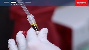 Stool DNA Extraction Guide | Microbial & Host DNA Purification