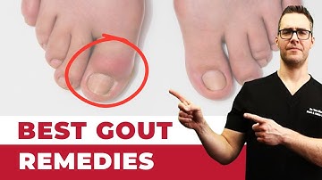 🔥What is Gout? TRUE Causes & Treatments! [Symptoms, Diet & Diagnosis]