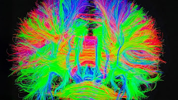 Brain Factory / How to create a Human Brain