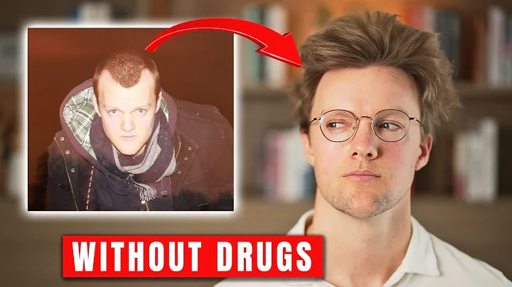 Hair Loss Industry Exposed! - How I regrew my hair after 10 years of male pattern baldness