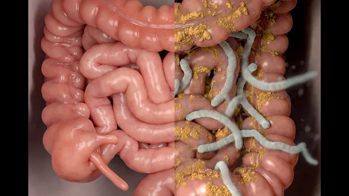 1 in 7 Americans Bloated → The Hidden Gut Invasion Causing It