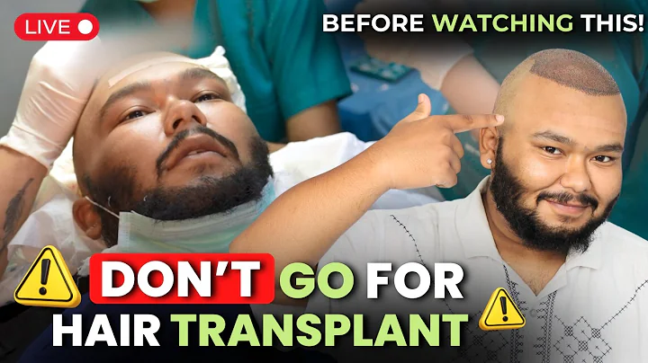 Hair Transplant Surgery | Hair Transplant Live Video | Hair Transplant Procedure | QHT Clinic #qht