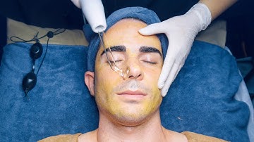 ASMR: Satisfying Acne Removal & Vacuum Facial Massage Treatment in Vietnam