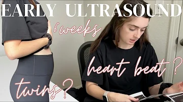 6 Weeks Ultrasound | Heart Beat?! Twin?! | #pregnancy