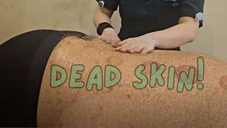 ASMR Bliss 🌟: The Vivid Sound of Exfoliating Dead Skin Cells