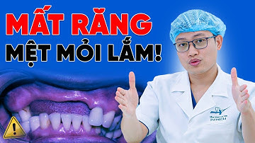 Mất răng quá lâu có trồng được implant không?