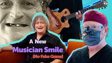 Undergoing a Whole Mouth Teeth Replacement as a Musician - My 3 on 6 Procedure Changed Everything