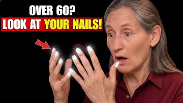 Check Your Fingernails RIGHT NOW — 4 Hidden Signs You Can’t Afford to Ignore! | Barbara O