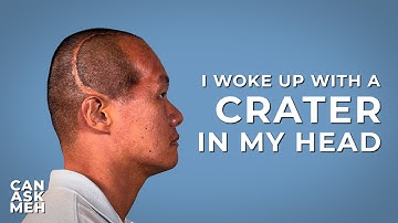 Life After a Traumatic Brain Injury | Can Ask Meh?