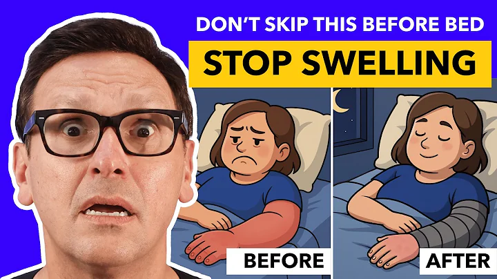 How to Stop Swelling While You Sleep!