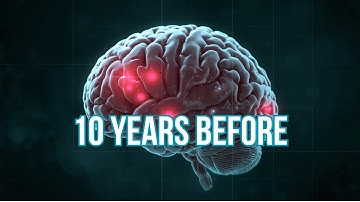 Alzheimer’s Starts 10 Years Early - This AI Sees It First