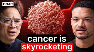 Chronic Disease Doctor: We Can Now Reverse Some Stage 4 Cancer?