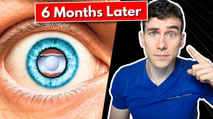 ICL Surgery 6-Month Update: The Good, The Bad, and the Unexpected