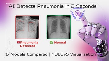 🩺 Pneumonia Detection: A Full Deep Learning Project with 6 AI Models (Python, Streamlit, FastAPI) AI