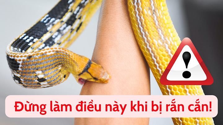 Chuyện gì xảy ra khi bị rắn độc cắn? Coi chừng mất mạng!