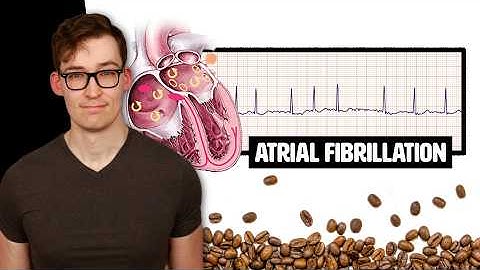 Coffee and Heart Atrial Fibrillation: Counterintuitive New Study