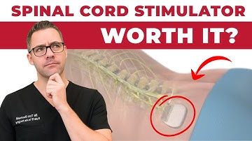 Spinal Cord Stimulator for Chronic Pain? [Neuropathy & Back Pain]