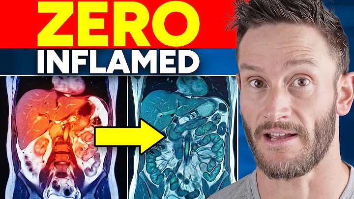 The Most Powerful Fasting Method for Eradicating STUCK Inflammation