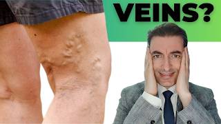 Varicose Veins: Causes, Symptoms and Treatment