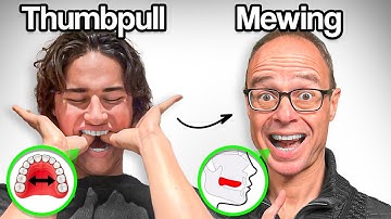 Mewing + Thumbpulling Full Guide (Ft. Dr Mike Mew)