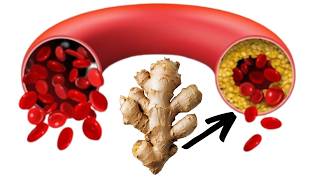 Top 10 Natural Remedies Against BLOOD CLOTS!