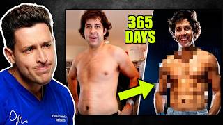 Doctor Reacts To David Dobrik's Body Transformation