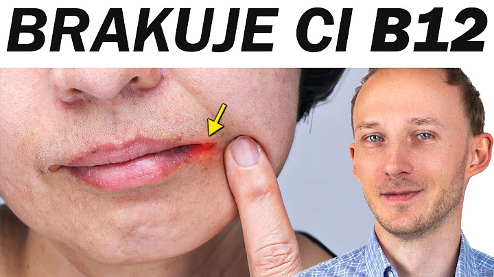 Gdy masz niedobór B12, na skórze i ustach pojawi się to