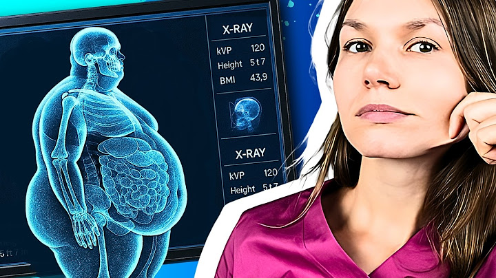 🎯 Obesity AND WRINKLES? Nobody Told You That!