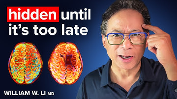 The #1 SIMPLE Way To STOP Dementia Before It Starts I Dr. William Li