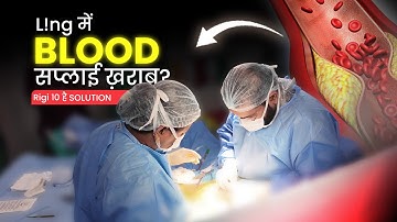 8 साल पुराना ED खत्म |  Penile Implant है Final Solution | Rigi 10 Implant