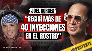JOEL BORGES: 'I went from TV to a deformed figure'