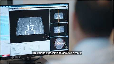 SwiftMR Case Study: CHIRON