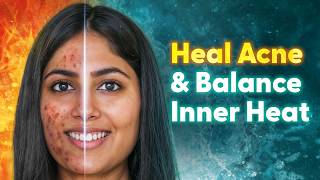 Ayurvedic Diet Plan to Heal Acne and Acidity