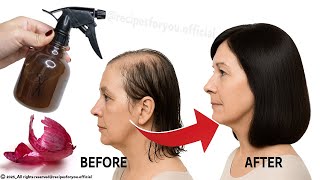 Download lagu My Hair Started Growing Again After Using This Spray β Perfect for Women 55 πββοΈβ¨