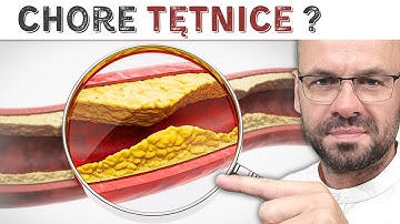 Uratuj TĘTNICE zanim zaczną chorować!