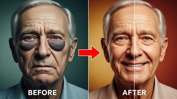 Japan’s Oldest Doctor Reveals the ONLY Way to Permanently Fix Puffy Eyes After 60