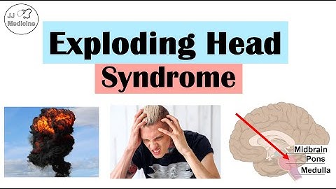 Exploding Head Syndrome (Loud Noises When Falling Asleep) | Triggers, Symptoms, Diagnosis, Treatment