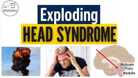 Exploding Head Syndrome (Loud Noises When Falling Asleep) | Triggers, Symptoms, Diagnosis, Treatment