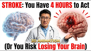 STROKE You Have 4 HOURS to Act Or You Risk Losing Your Brain