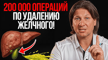 Эти продукты выводят желчь БЕЗ ЛЕКАРСТВ! / Как избежать застоя желчи и образования камней?
