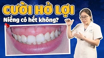 Niềng Răng Có Hết Cười Hở Lợi Không? 30 Giây Kiểm Tra Xem Bạn Niềng Có Hết Cười Hở Lợi Không!